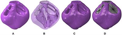 Construction and Validation of Subject-Specific Biventricular Finite-Element Models of Healthy and Failing Swine Hearts From High-Resolution DT-MRI